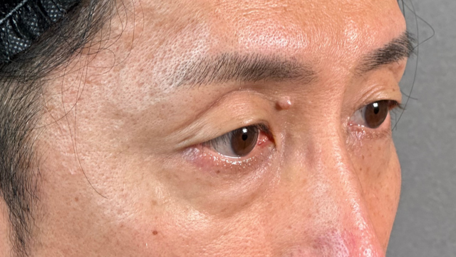 手術前の状態 その1