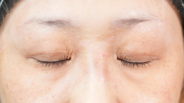 手術前の状態 その1