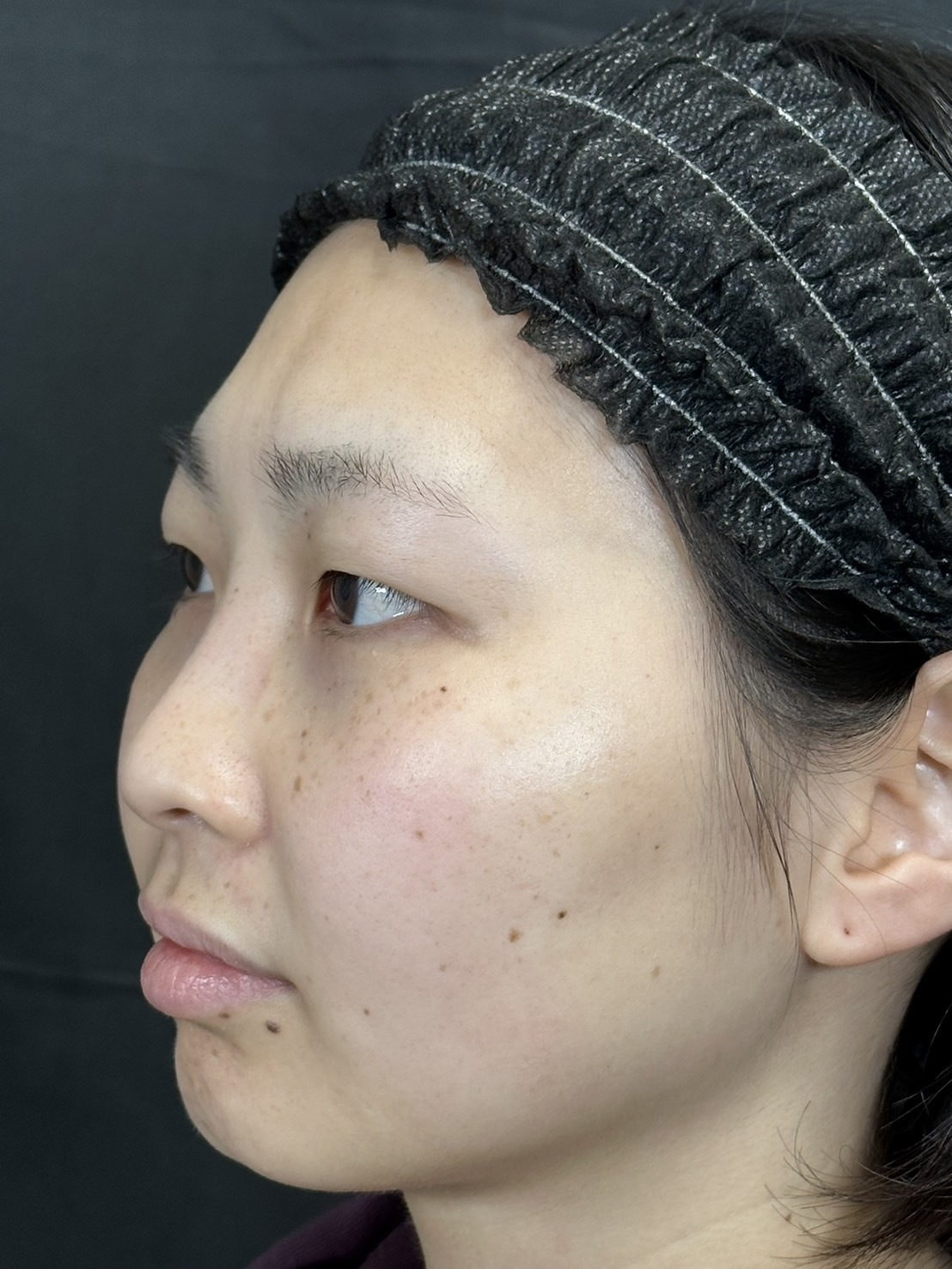 手術前の状態 その1