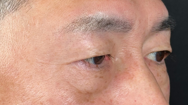 手術前の状態 その1