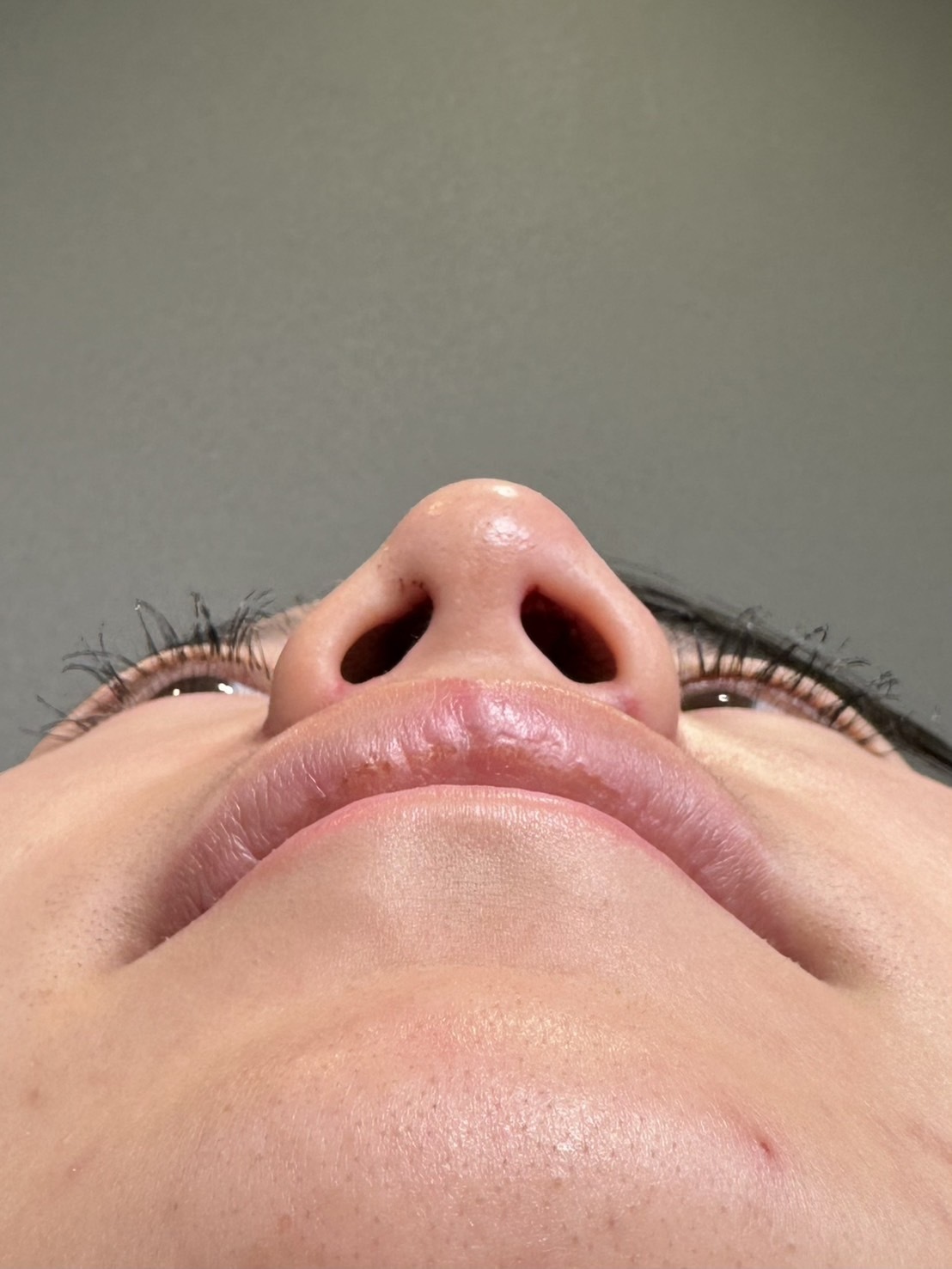 手術前の状態 その1