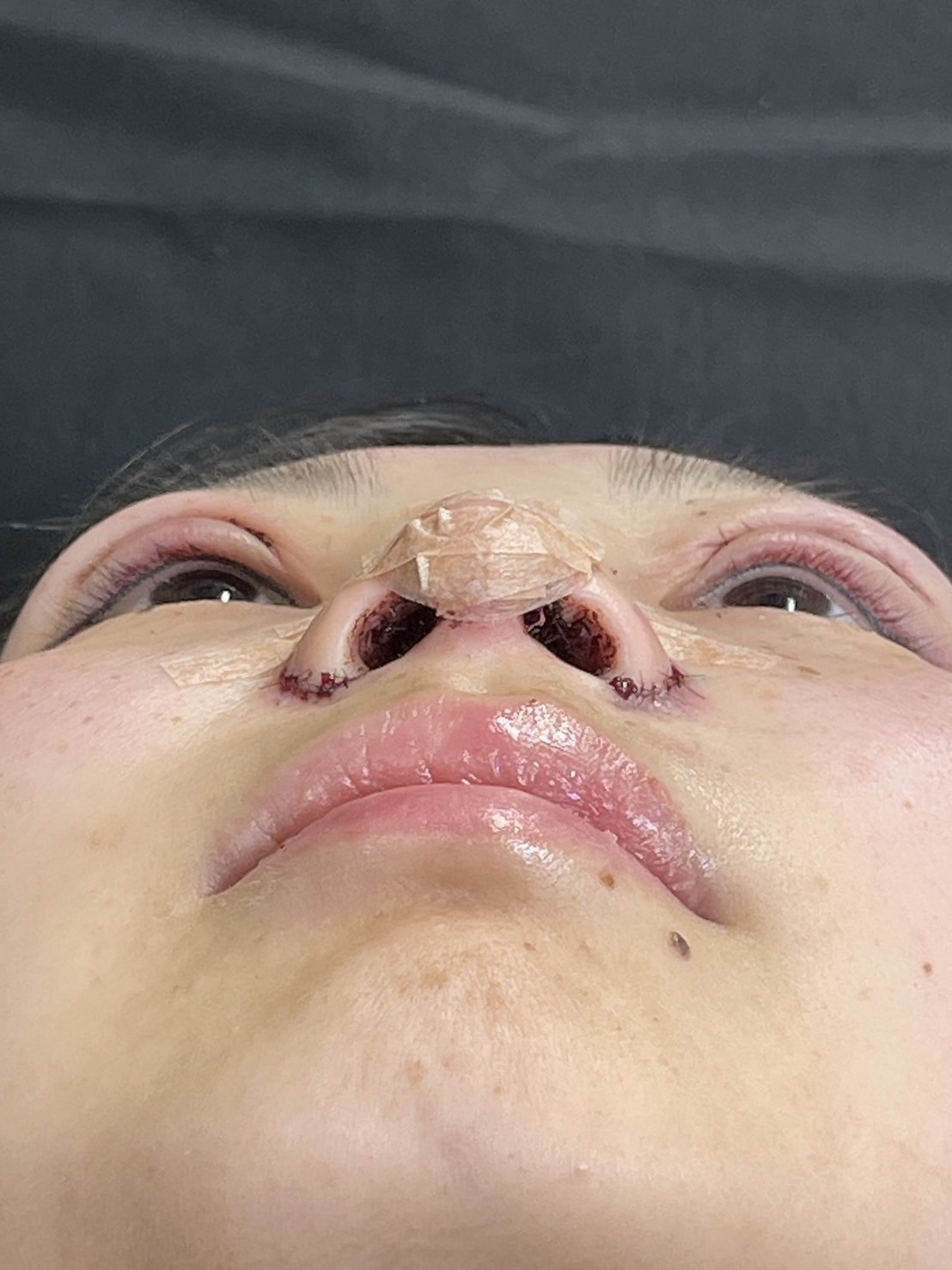 手術前の状態 その1