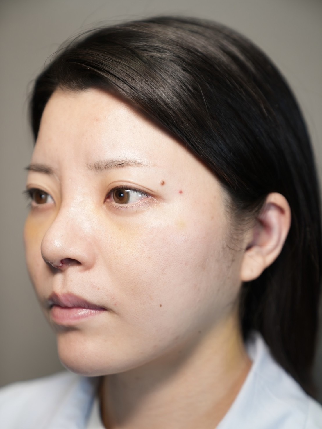 手術前の状態 その1