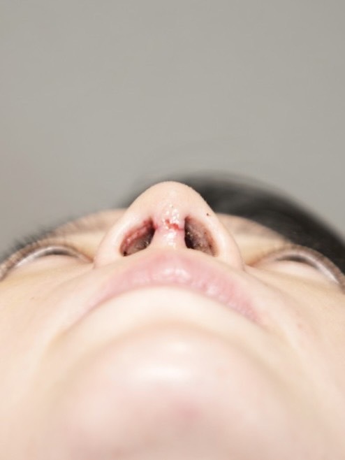 手術前の状態 その1