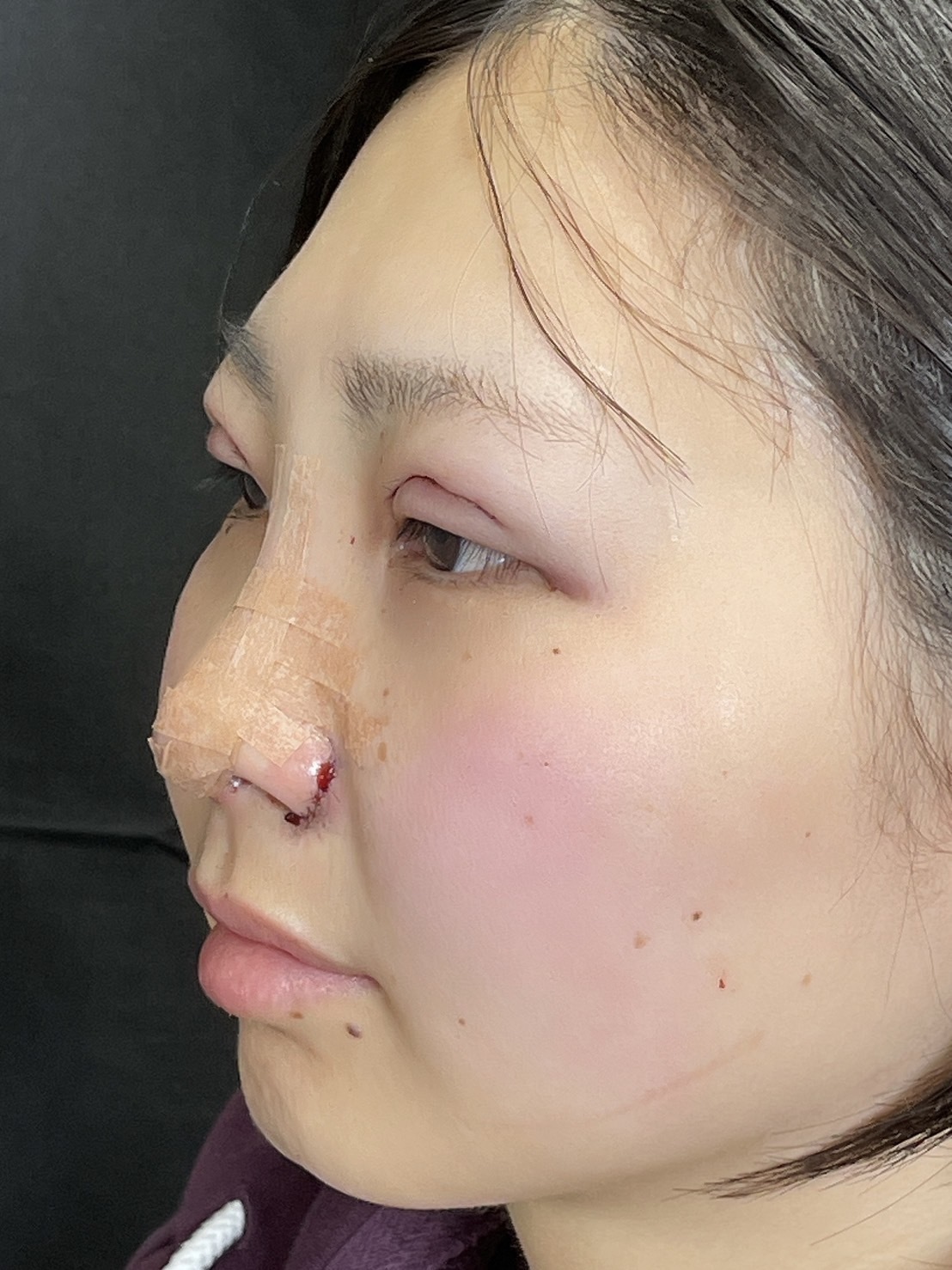 手術前の状態 その1