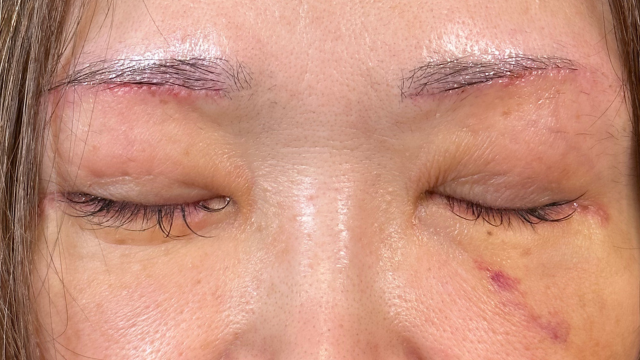 手術前の状態 その1