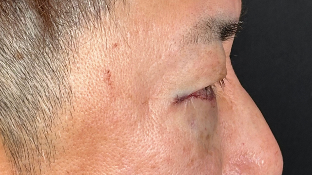 手術前の状態 その1