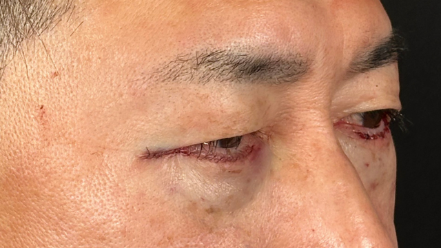 手術前の状態 その1