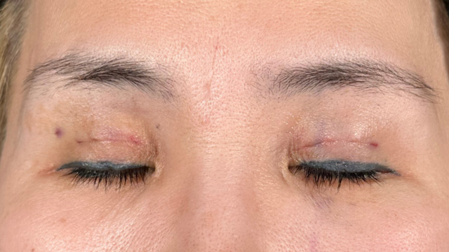 手術前の状態 その1