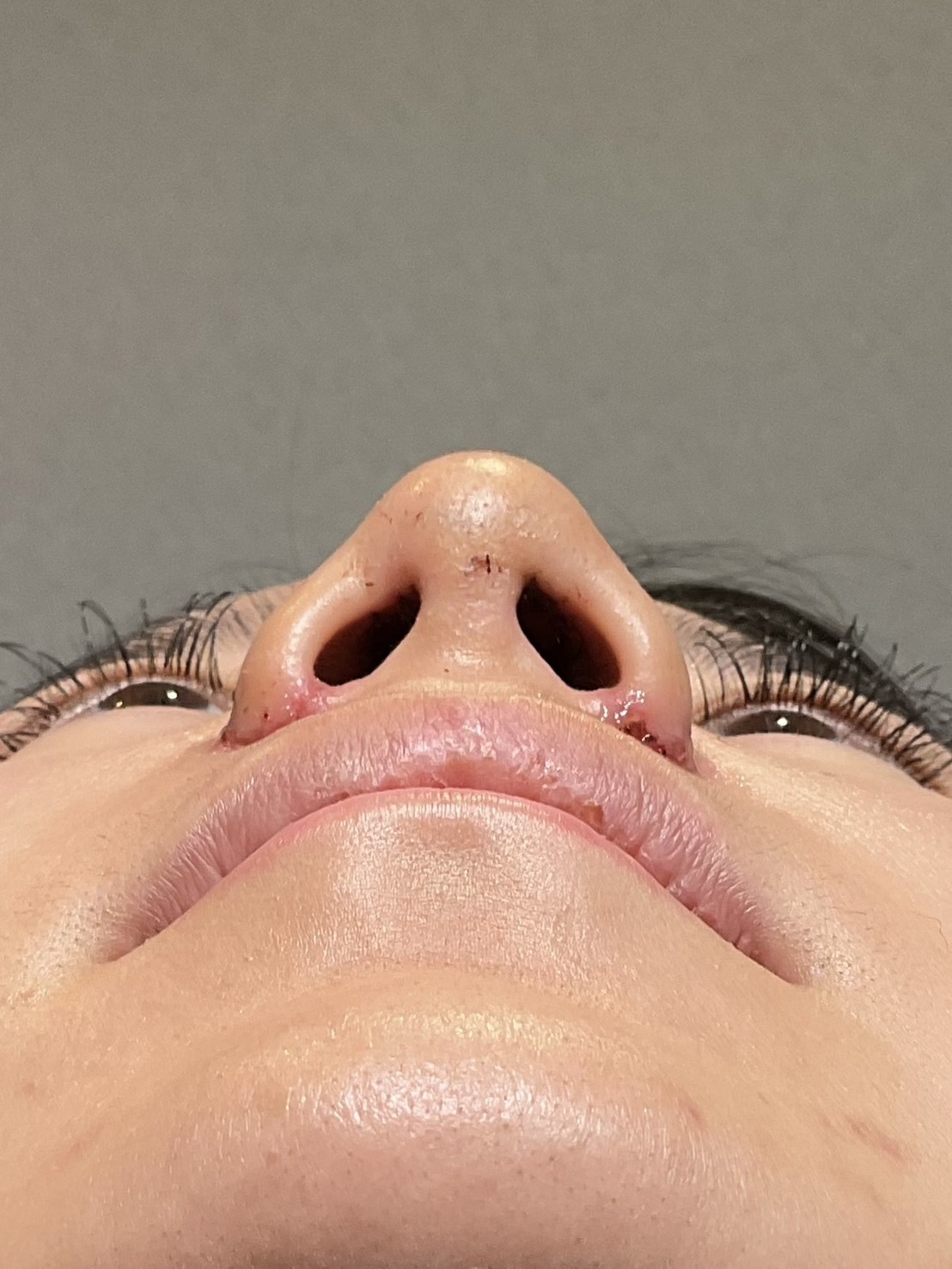 手術前の状態 その1