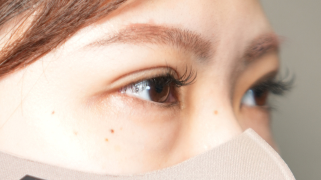 手術前の状態 その1