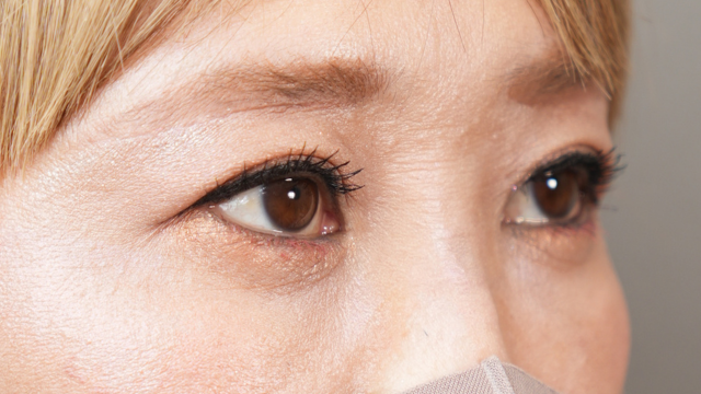 手術前の状態 その1