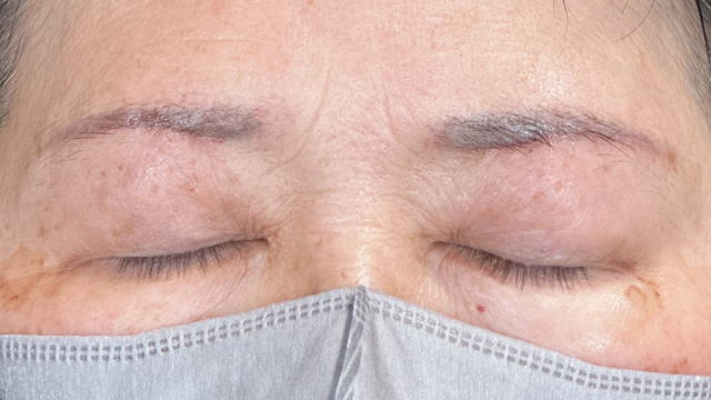 手術前の状態 その1