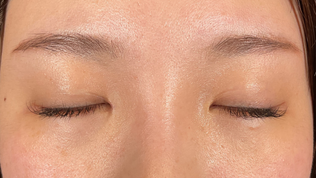 手術前の状態 その1