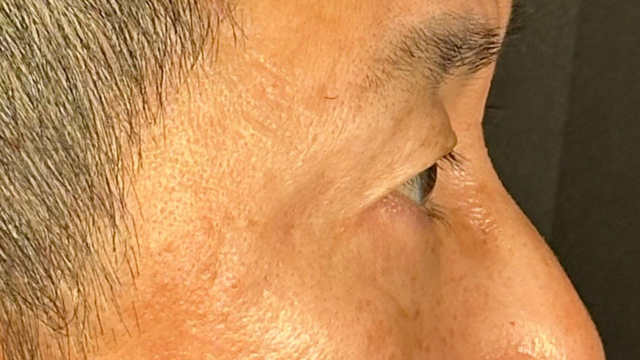 手術前の状態 その1