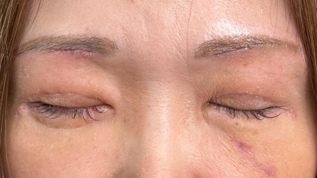 手術前の状態 その1