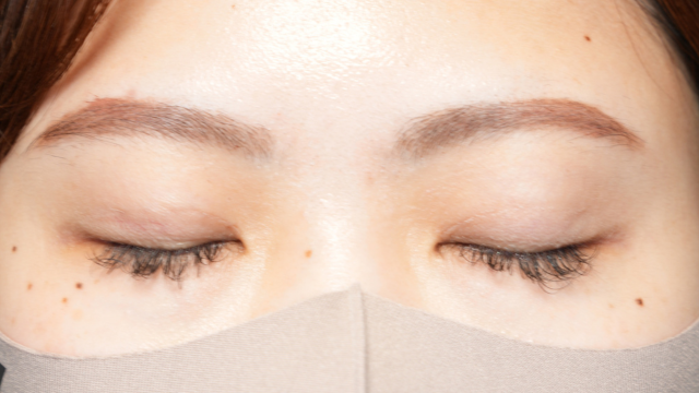 手術前の状態 その1