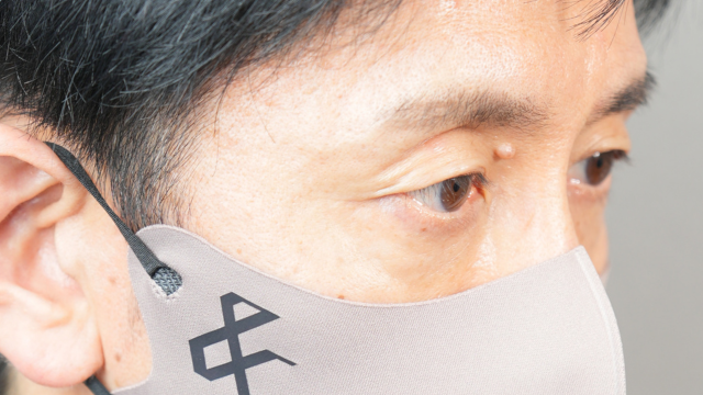 手術前の状態 その1