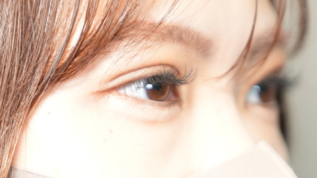 手術前の状態 その1