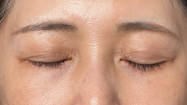 手術前の状態 その1