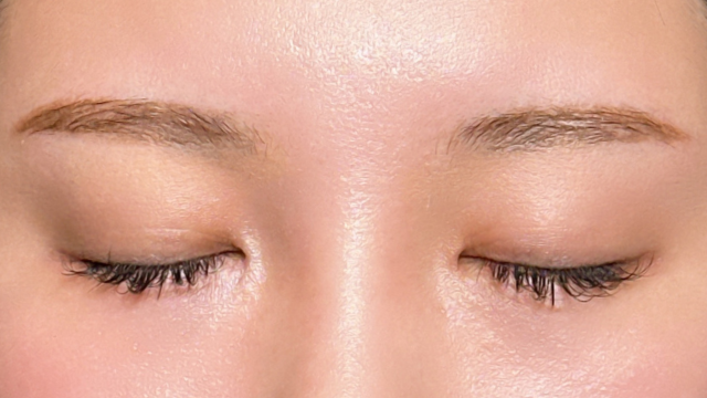 手術前の状態 その1