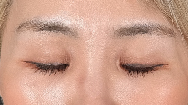 手術前の状態 その1