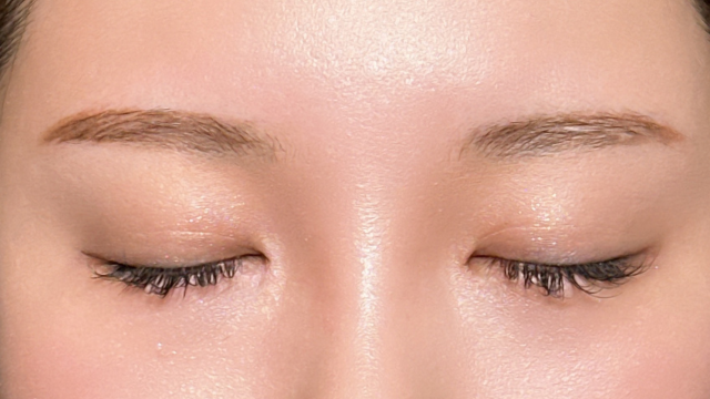 手術前の状態 その1