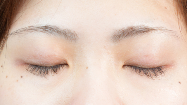 手術前の状態 その1