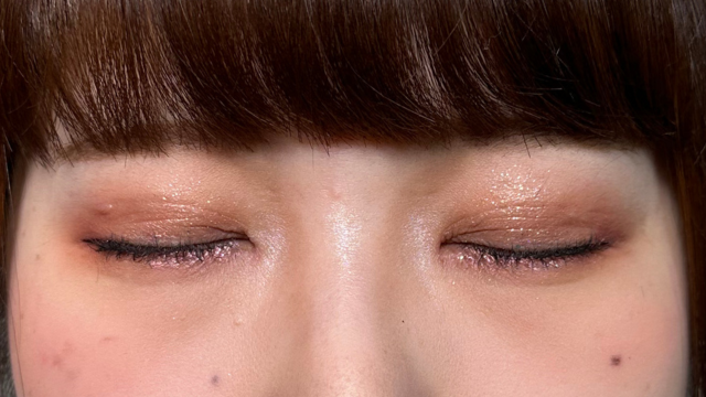 手術前の状態 その1