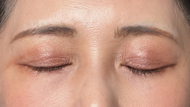 手術前の状態 その1