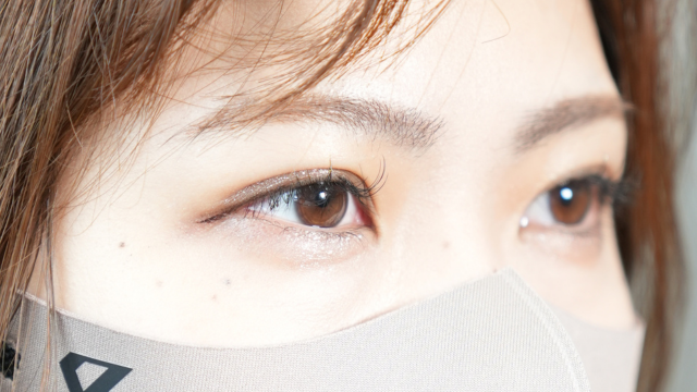 手術前の状態 その1