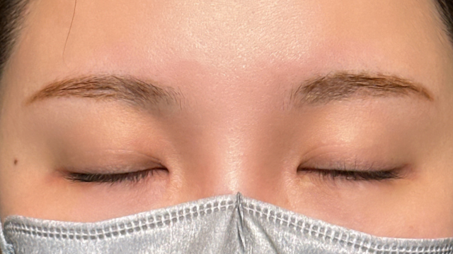 手術前の状態 その1