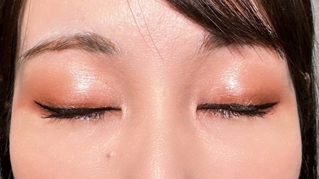 手術前の状態 その1