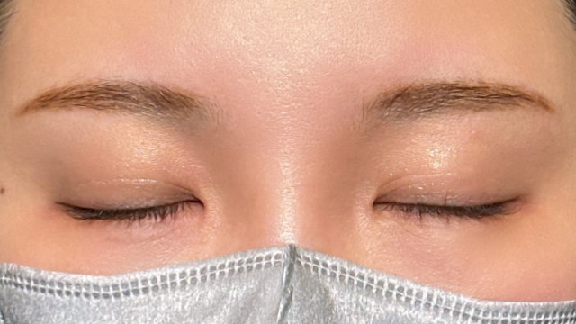 手術前の状態 その1